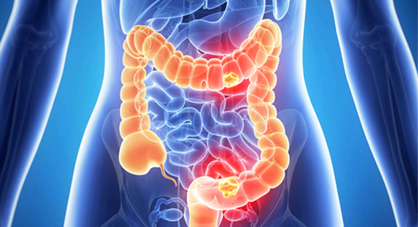 Optimizing Gut-Organ Axes: Gut-Brain Axis Benefits, Gut-Skin Axis Connection, and Fermented Foods vs Fiber for Inflammation