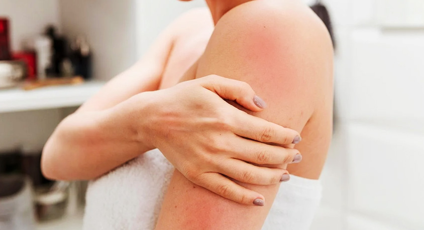 Why Your Skin Itches More After a Hot Shower &ndash; Aging Skin Needs Different Care